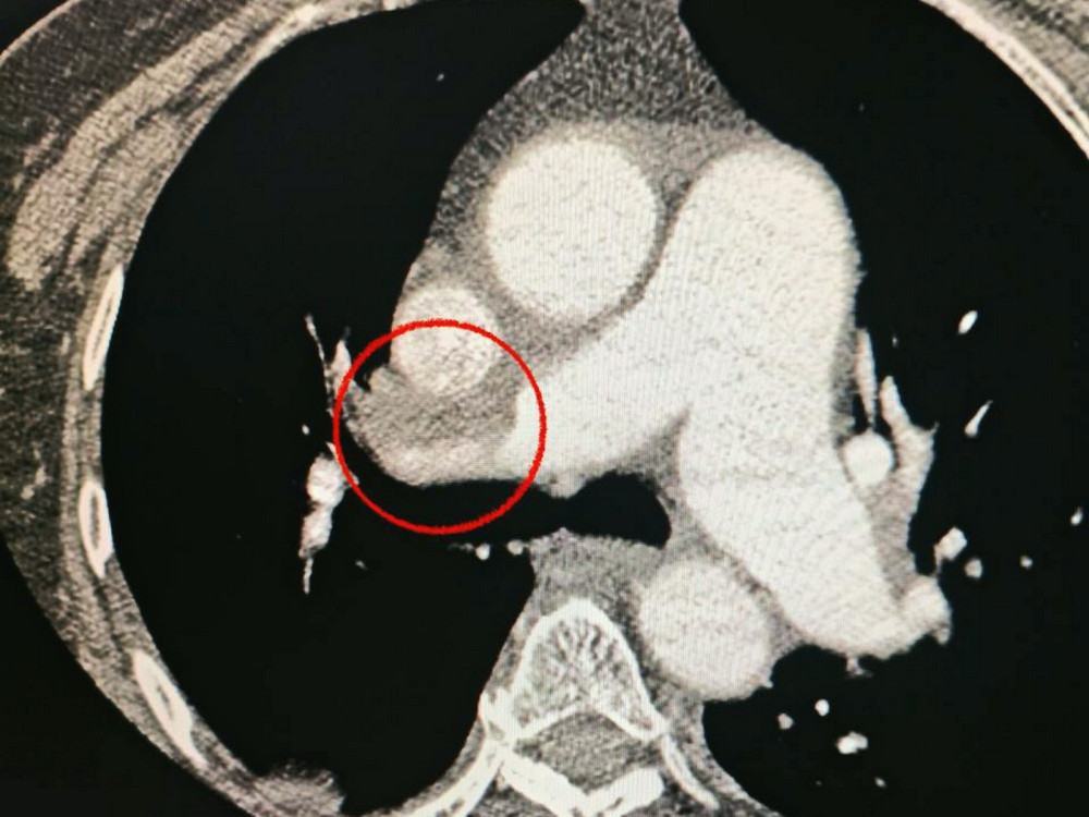 9960 image for slide